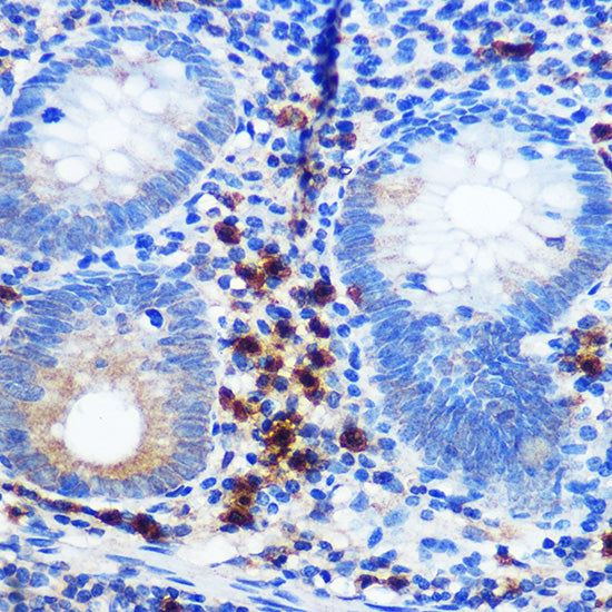 CD41/ITGA2B Rabbit mAb