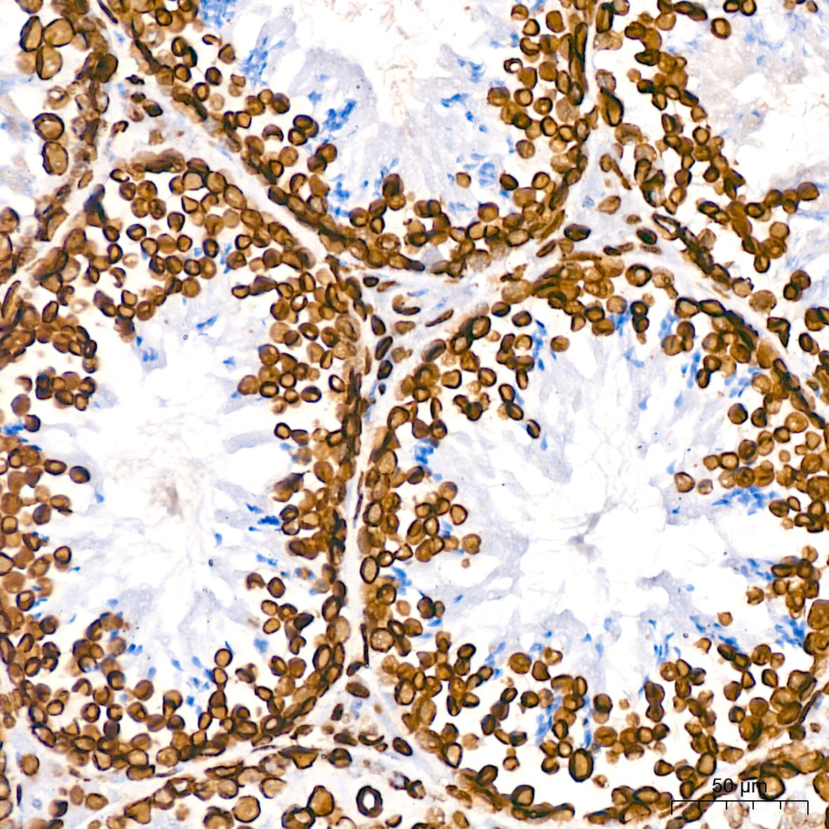 Lamin B1 Rabbit mAb