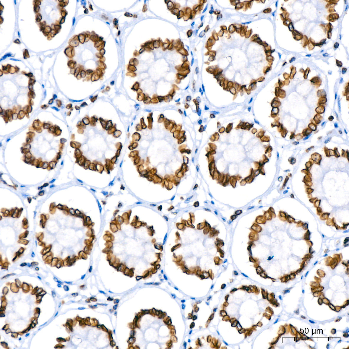 Lamin B1 Rabbit mAb
