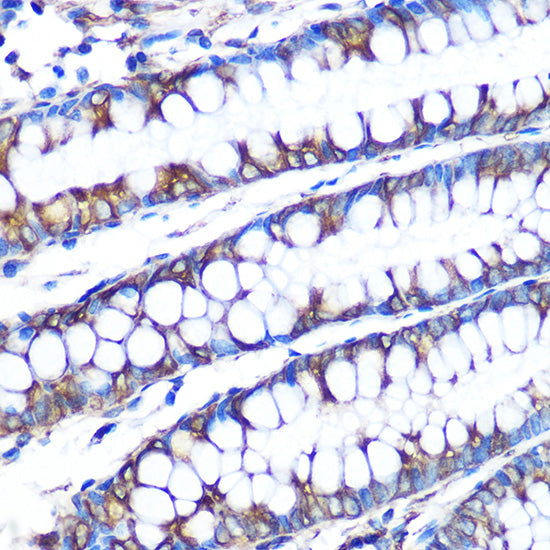 LOX Rabbit mAb