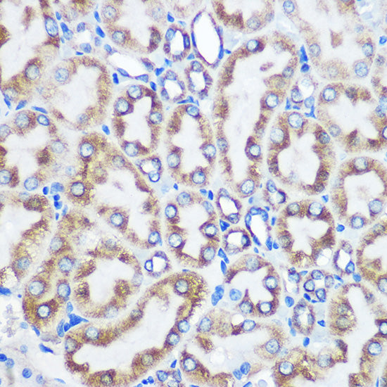 LOX Rabbit mAb