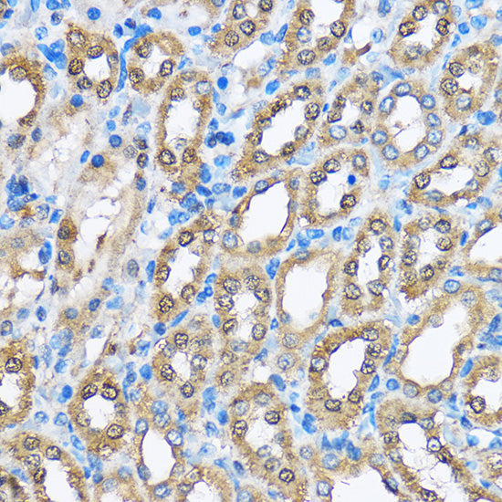 PHD2/EGLN1 Rabbit pAb