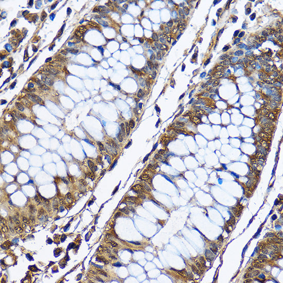 PHD2/EGLN1 Rabbit pAb