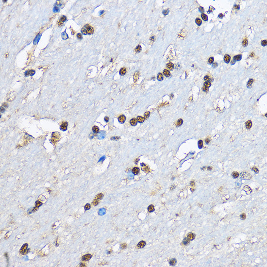 PHD2/EGLN1 Rabbit pAb