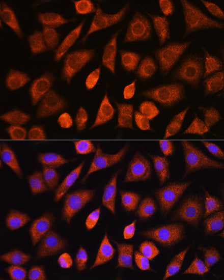 PHD2/EGLN1 Rabbit pAb