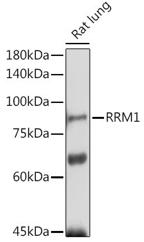 RRM1 Rabbit pAb