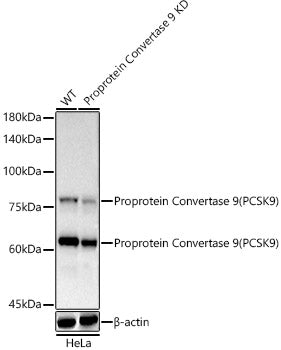 [KD Validated] Proprotein Convertase 9(PCSK9) Rabbit mAb