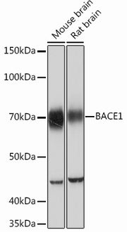 BACE1 Rabbit mAb
