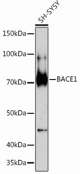 BACE1 Rabbit mAb