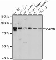 GOLPH2 Rabbit mAb