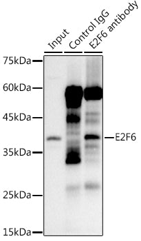 E2F6 Rabbit mAb