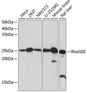 [KO Validated] RhoGDI Rabbit mAb