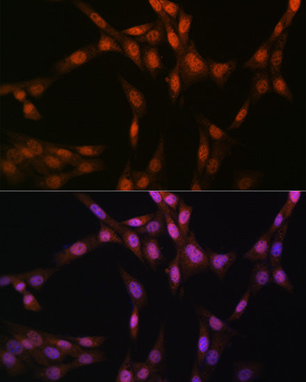 Glutathione Synthetase (GSS) Rabbit mAb