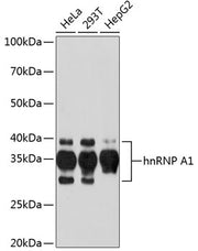 hnRNP A1 Rabbit mAb