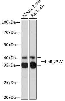 hnRNP A1 Rabbit mAb