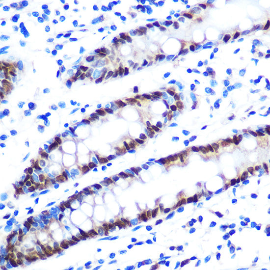 hnRNP A1 Rabbit mAb