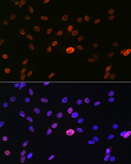 hnRNP A1 Rabbit mAb