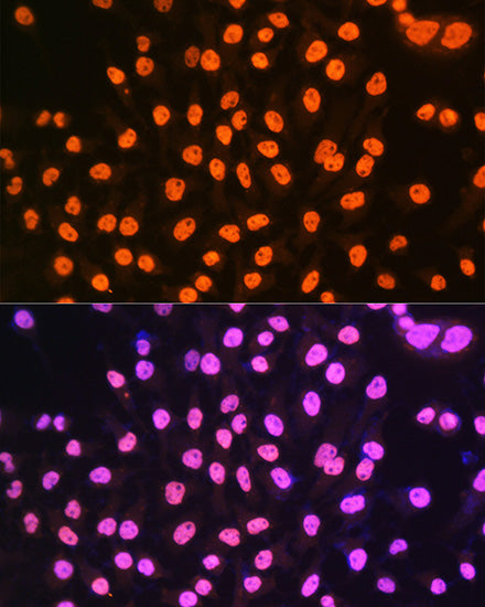 hnRNP A1 Rabbit mAb