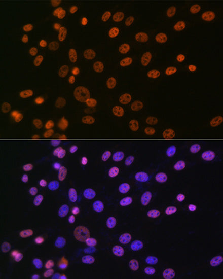 hnRNP A1 Rabbit mAb