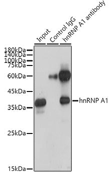 hnRNP A1 Rabbit mAb
