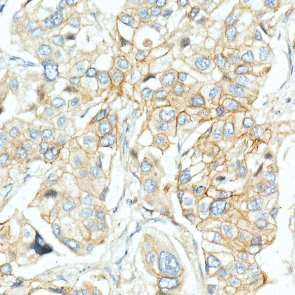[KD Validated] EGFR Rabbit pAb