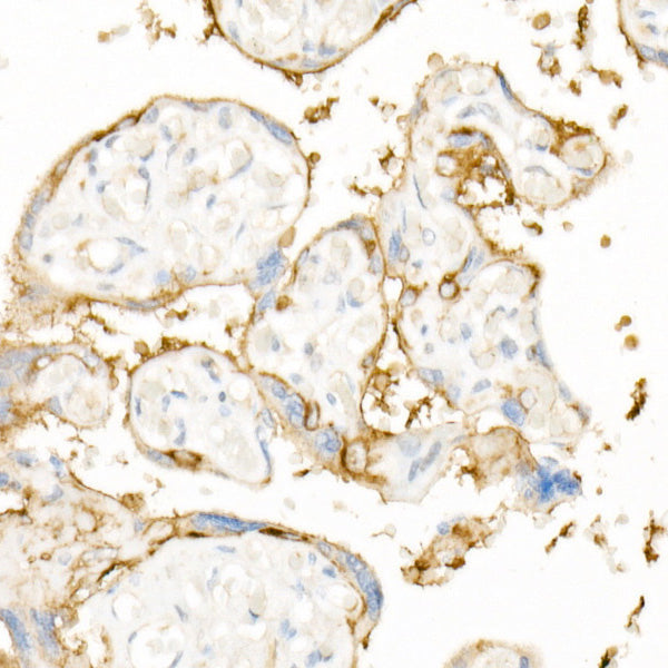 [KD Validated] EGFR Rabbit pAb