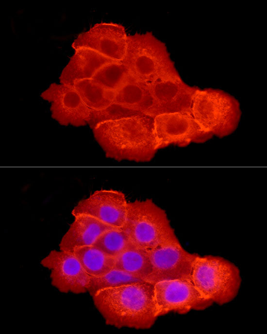 [KD Validated] EGFR Rabbit pAb