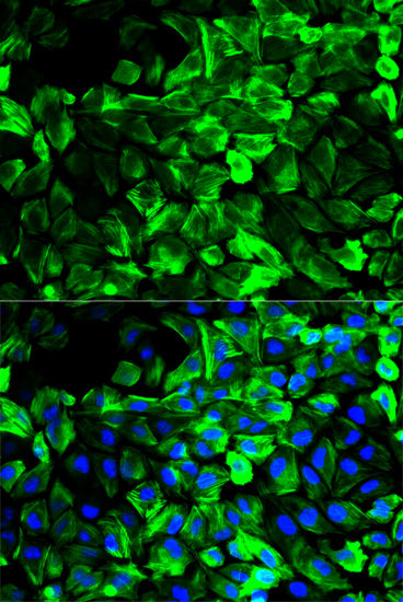 Tropomyosin 1 Rabbit pAb