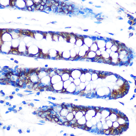 Lumican (LUM) Rabbit mAb