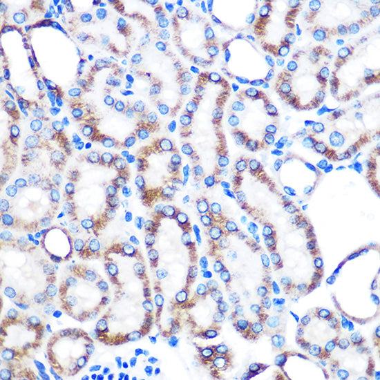 Lumican (LUM) Rabbit mAb