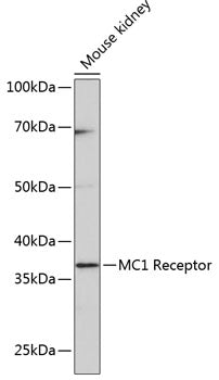 MC1 Receptor Rabbit mAb