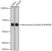 Monoamine Oxidase B (MAOB) Rabbit mAb