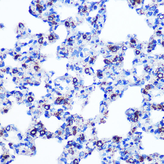 Monoamine Oxidase B (MAOB) Rabbit mAb