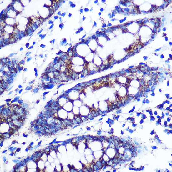 Monoamine Oxidase B (MAOB) Rabbit mAb