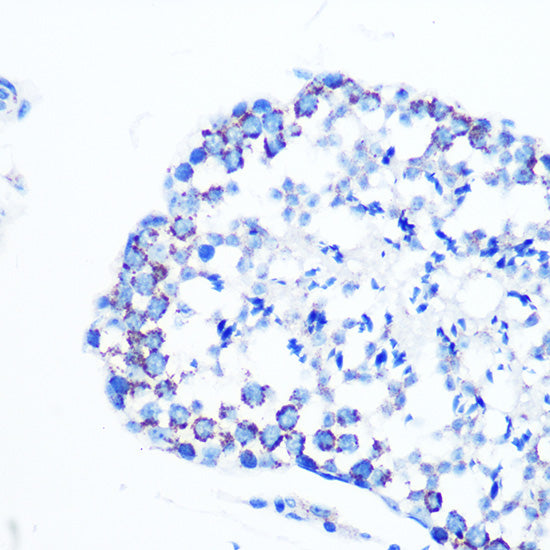 Monoamine Oxidase B (MAOB) Rabbit mAb