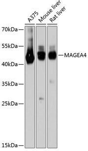 MAGEA4 Rabbit pAb
