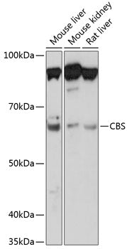 CBS Rabbit mAb
