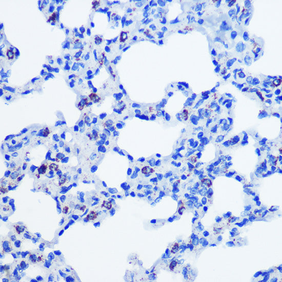 CBS Rabbit mAb