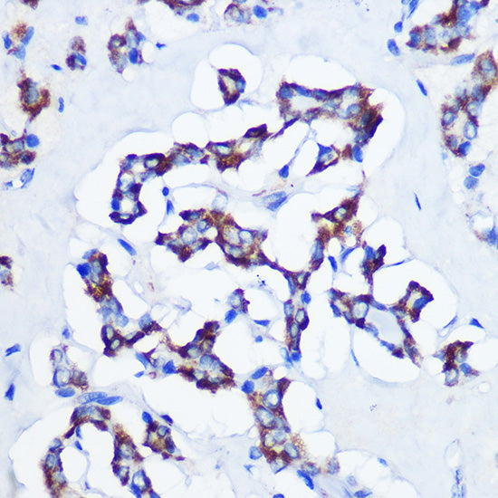 CBS Rabbit mAb