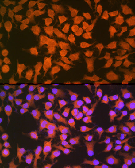 CBS Rabbit mAb