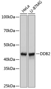 DDB2 Rabbit mAb