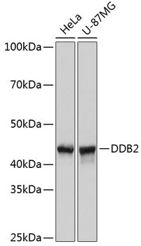 DDB2 Rabbit mAb