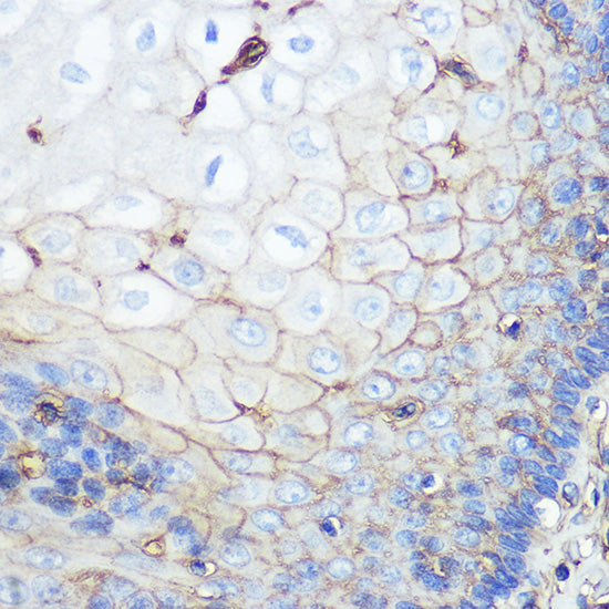 beta 2 Microglobulin Rabbit mAb