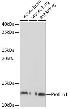 Profilin1 Rabbit pAb