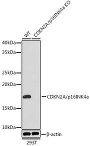 [KO Validated] CDKN2A/p16INK4a Rabbit mAb