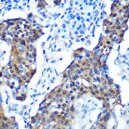 [KO Validated] CDKN2A/p16INK4a Rabbit mAb