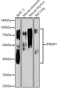 [KO Validated] IFNGR1 Rabbit mAb