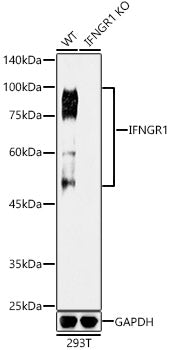 [KO Validated] IFNGR1 Rabbit mAb