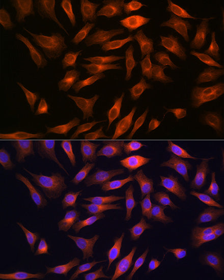 FBP1 Rabbit mAb