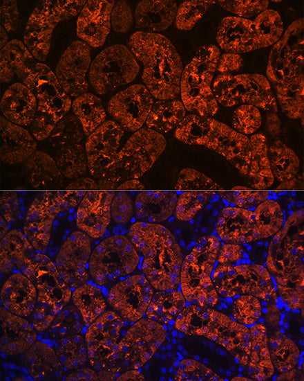 FBP1 Rabbit mAb